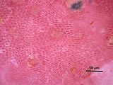 5 - Cellule ipotalliche poliflabellate